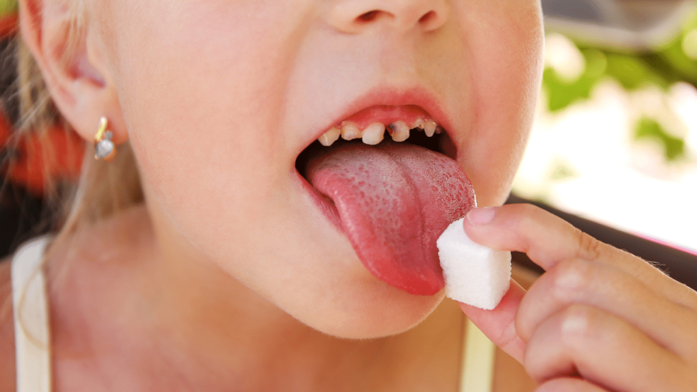 le sucre chez les enfants et ses différentes formes