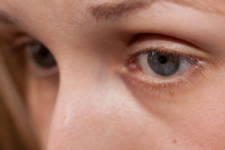 signe niveau yeux prédit perte mémoire